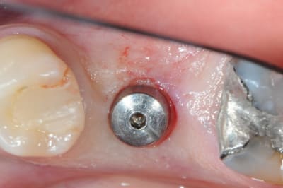 Dsc 5906 b7imv0 - Eugenol