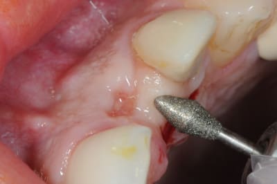 Dsc 5974 q7ubfx - Eugenol