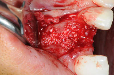 Dsc 5978 ajgoph - Eugenol