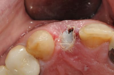 Dsc 6017 ojt5i8 - Eugenol