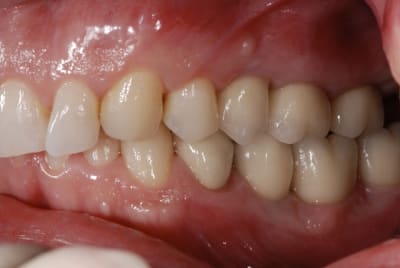 Dsc 6081 qhlsym - Eugenol