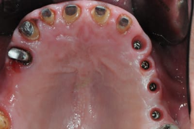 Dsc 6196 ci5k6a - Eugenol