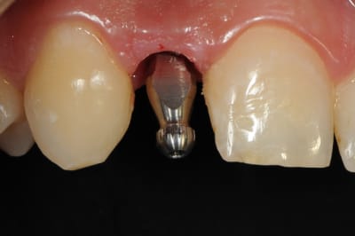 Dsc 6257 czt0k8 - Eugenol