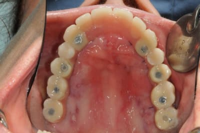 Dsc 6376 ajtron - Eugenol