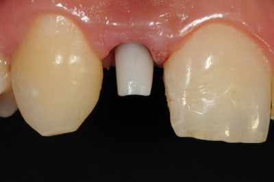 Dsc 6484 nhu65z - Eugenol