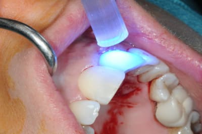 Dsc 6496 zsxlec - Eugenol