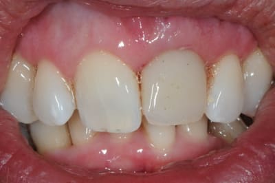 Dsc 6504 q4l2od - Eugenol