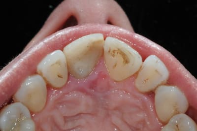 Dsc 6518 jajzsy - Eugenol