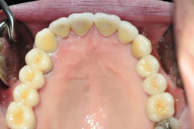 Dsc 6554 ehabsx - Eugenol