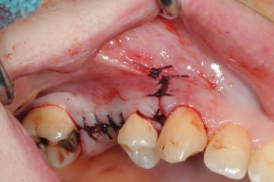 Dsc 7212 js6ax2 - Eugenol