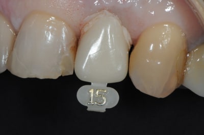 Dsc 7346 yncb4a - Eugenol