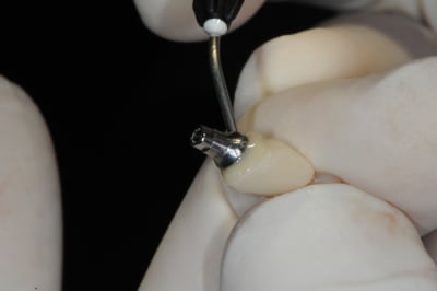 Dsc 7352 galzjp - Eugenol