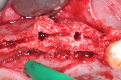 Dsc 7721 kwglkw - Eugenol