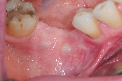 Dsc 7787 zb8okv - Eugenol