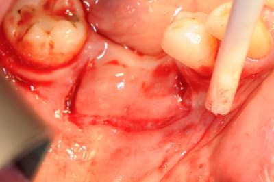 Dsc 7791 fikufb - Eugenol