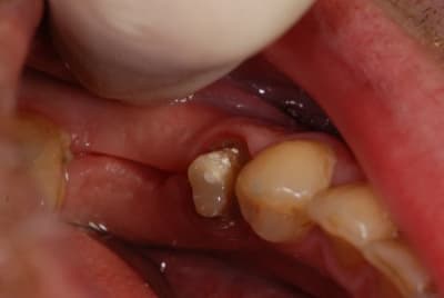 Dsc 7885s i1virj - Eugenol