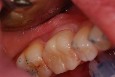 Dsc 7920s y4zmdm - Eugenol