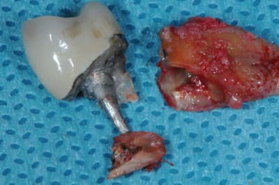 Dsc 7940 hppn1f - Eugenol