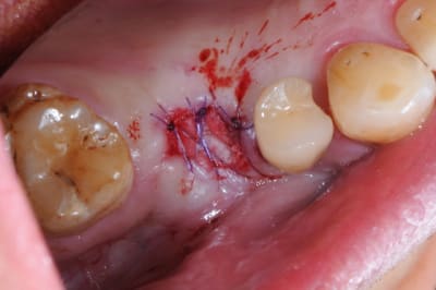 Dsc 8862 gjw6ow - Eugenol