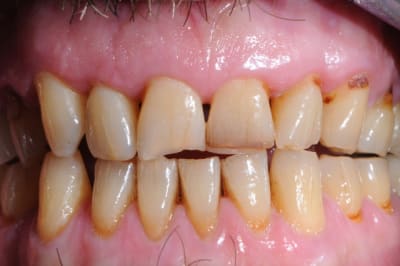 Dsc 9031 tugsta - Eugenol