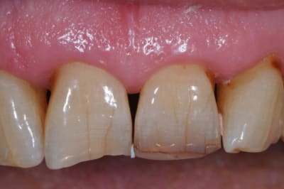 Dsc 9033 vfxolz - Eugenol