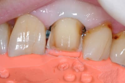 Dsc 9034 ey9vqo - Eugenol