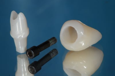 Dsc 9308 aeoxe1 - Eugenol