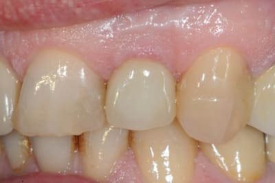 Dsc 9626 tuby7w - Eugenol