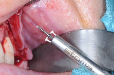 Dsc 9740 gochdx - Eugenol