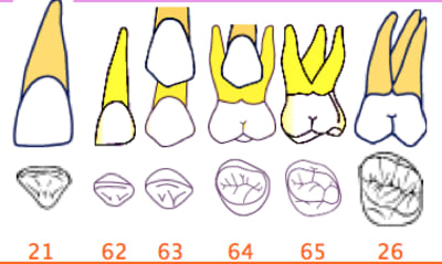 Dents de lait kdwv4k - Eugenol