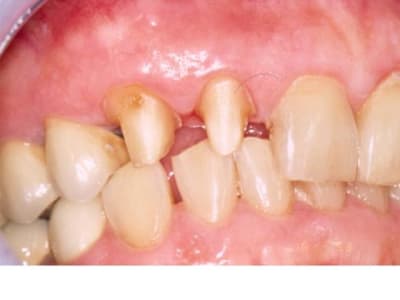 Diapositive2 uelgul - Eugenol