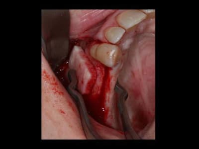 Diapositive4 dohnct - Eugenol