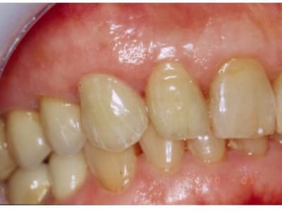 Diapositive4 xh5738 - Eugenol
