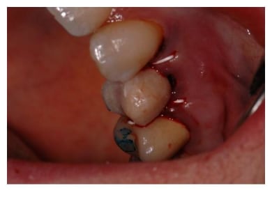 Diapositive6 jgxfk6 - Eugenol