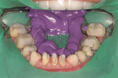 Digue j0eptl - Eugenol