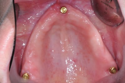 Dr thomas guillaumin locator p2srnr - Eugenol