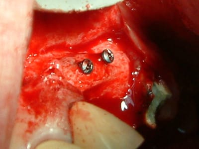 Dscf0088 fko9bl - Eugenol