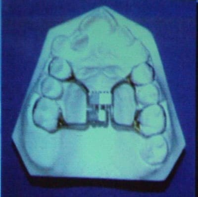 Dscf2087 1 i61scw - Eugenol