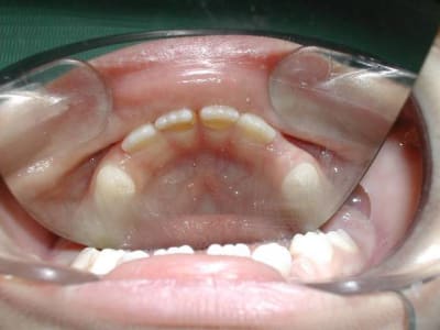 Dscn2061 su65j6 - Eugenol