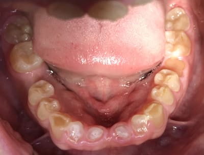 E2f69a8e 1293 4d24 bc42 b326036451b8 xx21g7 - Eugenol