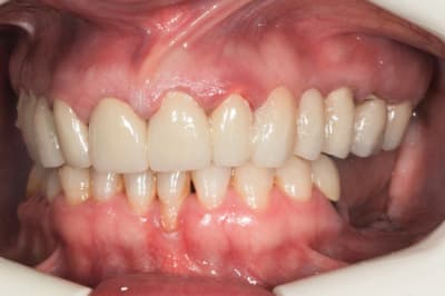 Egapres gg7snd - Eugenol