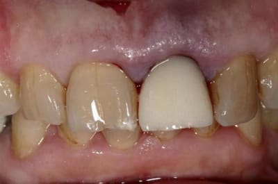 Eimic  4   large  gj5wpo - Eugenol