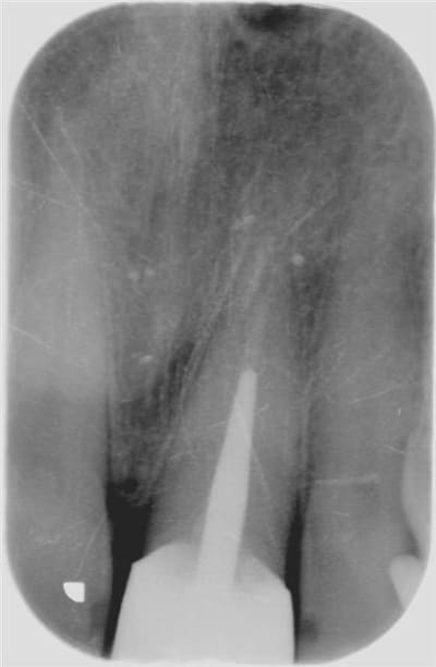 Eimic  large  sbt7xp - Eugenol