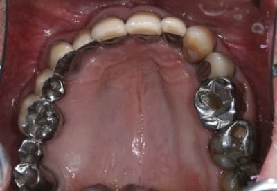 Ep vue sup ujiiet - Eugenol