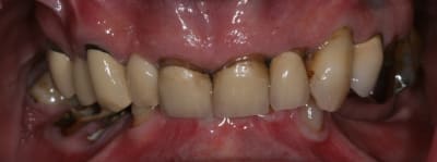 Ep vue intabucc ztygvn - Eugenol