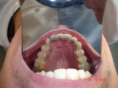 Exemple 1 tj5g2q - Eugenol