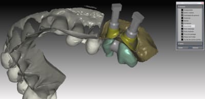 Emerg2 bufp2e - Eugenol