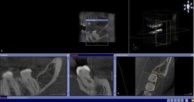 En 3d z2ajv8 - Eugenol