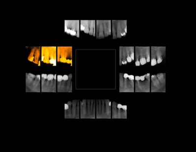 F1philippe impp9o - Eugenol