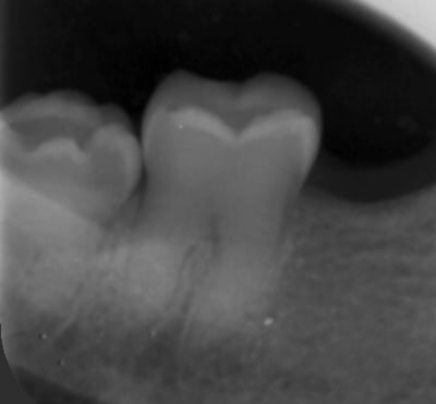 Fe906c66 839a 45f6 bf44 63d400366819 nrrdrk - Eugenol